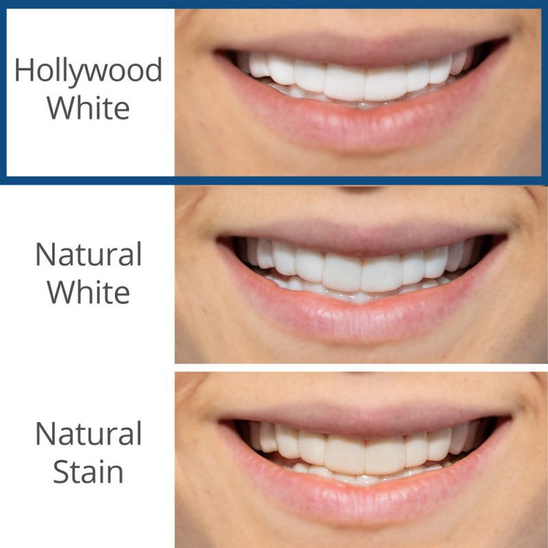 Product Veneers HollywoodWhite 3adf5fa8 c137 4a7a a7f6 48466e1e3b15