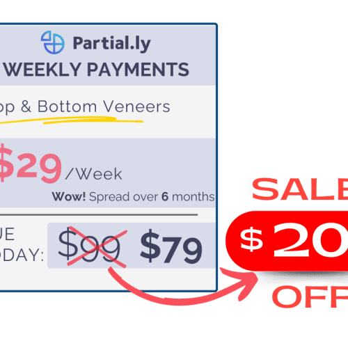 partially weekly payments 20 off