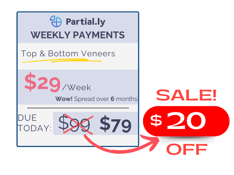 partially weekly payments 20 off