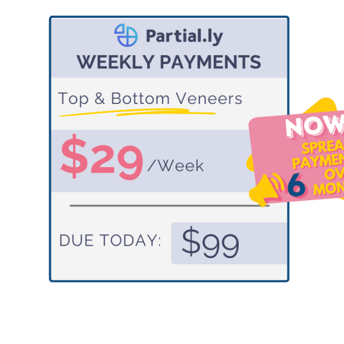 partiallyweeklypayments 7 1