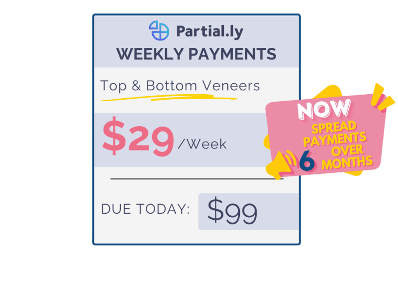 partiallyweeklypayments 7 1